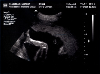 Baby Mojo